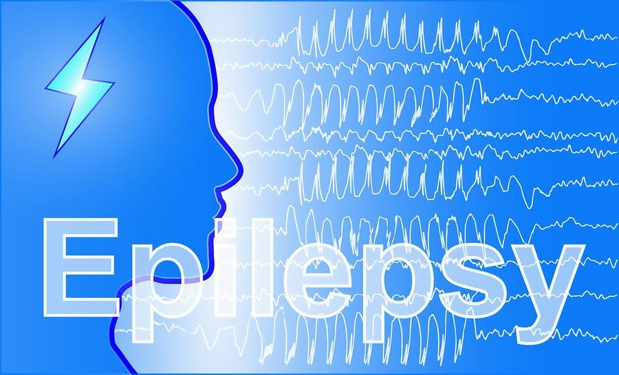 Cannabis and Epilepsy: How Cannabis and Its Derivatives Affect Involuntary Seizures