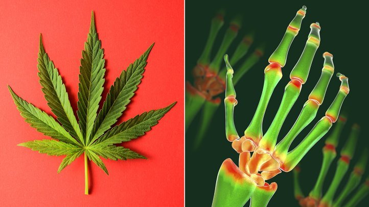 6 Health Benefits of Marijuana You Must Know